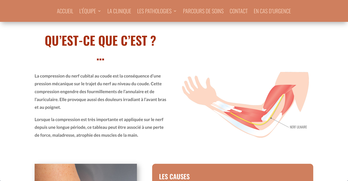 Création site internet Institut Chirurgie Main Dordogne - Adékoi Périgueux